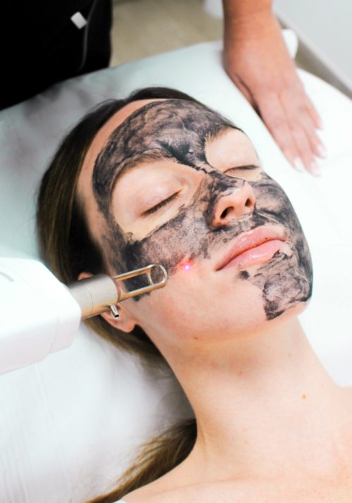 HollywoodPeel-001-min